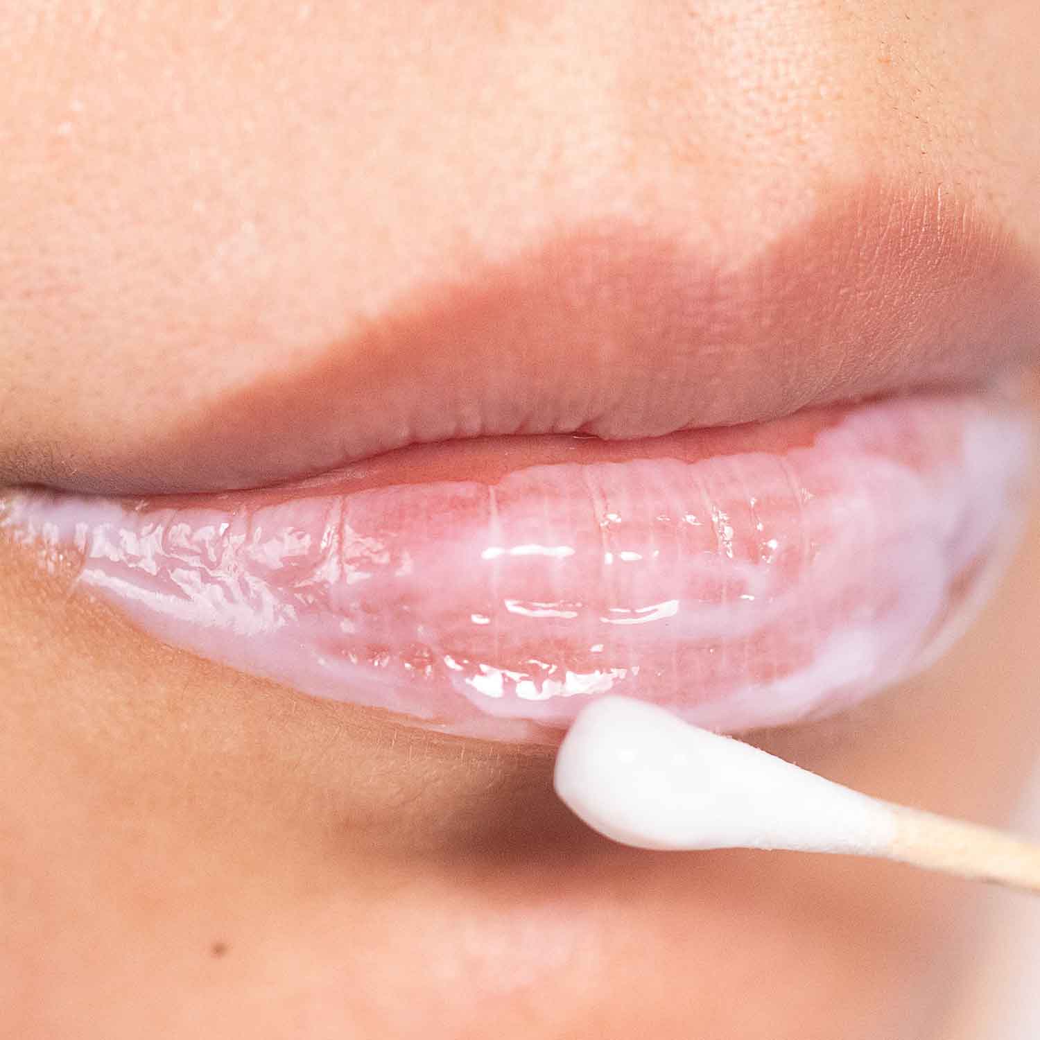 IceCream Topical Anesthetic Tina Davies - Image 4
